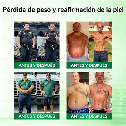𝑻𝒊𝒆𝒏𝒅𝒂 𝑶𝒇𝒊𝒄𝒊𝒂𝒍  | 🏷️ 𝑳𝒖𝒙𝒂𝒓𝒊𝒔𝒆® 10 𝑬𝑵 1 𝑴𝒐𝒓𝒊𝒏𝒈𝒂 𝒀 𝑩𝒆𝒓𝒃𝒆𝒓𝒊𝒏𝒂 𝑷𝒂𝒓𝒄𝒉𝒆 𝑨𝒗𝒂𝒏𝒛𝒂𝒅𝒐 𝑫𝒆 𝑴𝒊𝒄𝒓𝒐𝒏𝒆𝒆𝒅𝒍𝒆𝒔 𝑵𝒂𝒏𝒐（𝑼𝒏𝒂 𝒗𝒆𝒛 𝒂𝒍 𝒅í𝒂, 𝒄𝒂𝒎𝒃𝒊𝒐𝒔 𝒗𝒊𝒔𝒊𝒃𝒍𝒆𝒔 𝒆𝒏 7 𝒅í𝒂𝒔） ✅ 𝑶𝒃𝒆𝒔𝒊𝒅𝒂𝒅, 𝑫𝒊𝒂𝒃𝒆𝒕𝒆𝒔, 𝑨𝒑𝒏𝒆𝒂 𝒅𝒆𝒍 𝑺𝒖𝒆ñ𝒐 𝒚 𝑷𝒓𝒐𝒃𝒍𝒆𝒎𝒂𝒔 𝑨𝒓𝒕𝒊𝒄𝒖𝒍𝒂𝒓𝒆𝒔