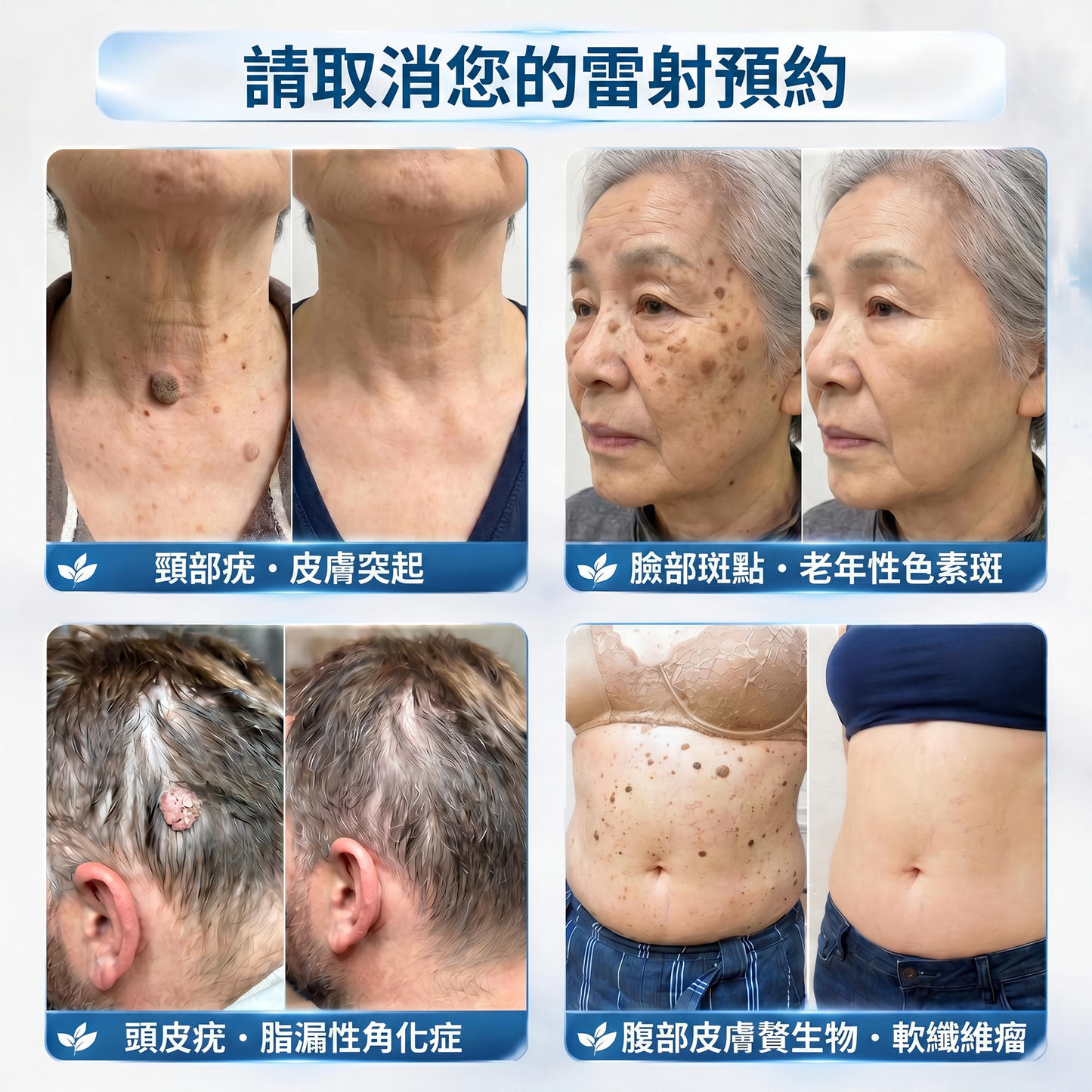 Picdo® 7天集中肌膚護理筆 精準滾珠設計｜輕鬆改善小肉芽與肌膚瑕疵 ✨